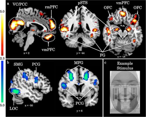 brain images